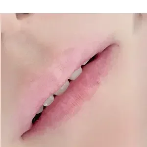 SOPHICATE（ソフィーケイト） リップアートメイクの施術前