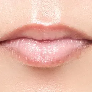Be&Me Clinic リップアートメイクの施術前