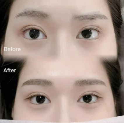 BROWDOLL 眉アートメイクの施術前後の比較