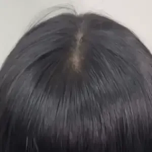 BROWDOLL ヘアラインアートメイクの施術後