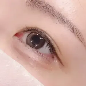 BROWDOLL 涙袋のアートメイクの施術後