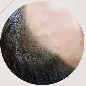 Delumina Beauty 江南店 ヘアラインアートメイクの施術後