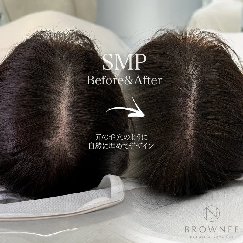 BROWNEE SMP（頭皮アートメイク）の施術前後を並べたバナー
