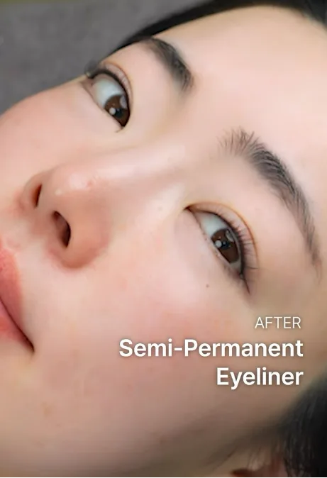 Be&Me Clinic アイラインアートメイクの仕上がり