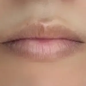 BROWDOLL リップアートメイクの施術前