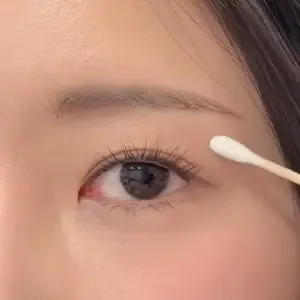 BROWDOLL 涙袋のアートメイクの施術前