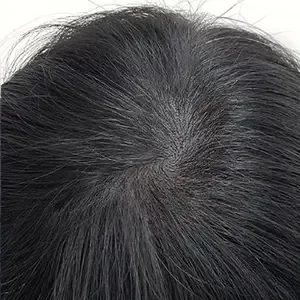 Delumina Beauty 江南店 ヘアラインアートメイクの施術後