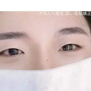 SOPHICATE（ソフィーケイト） 眉アートメイクの施術後