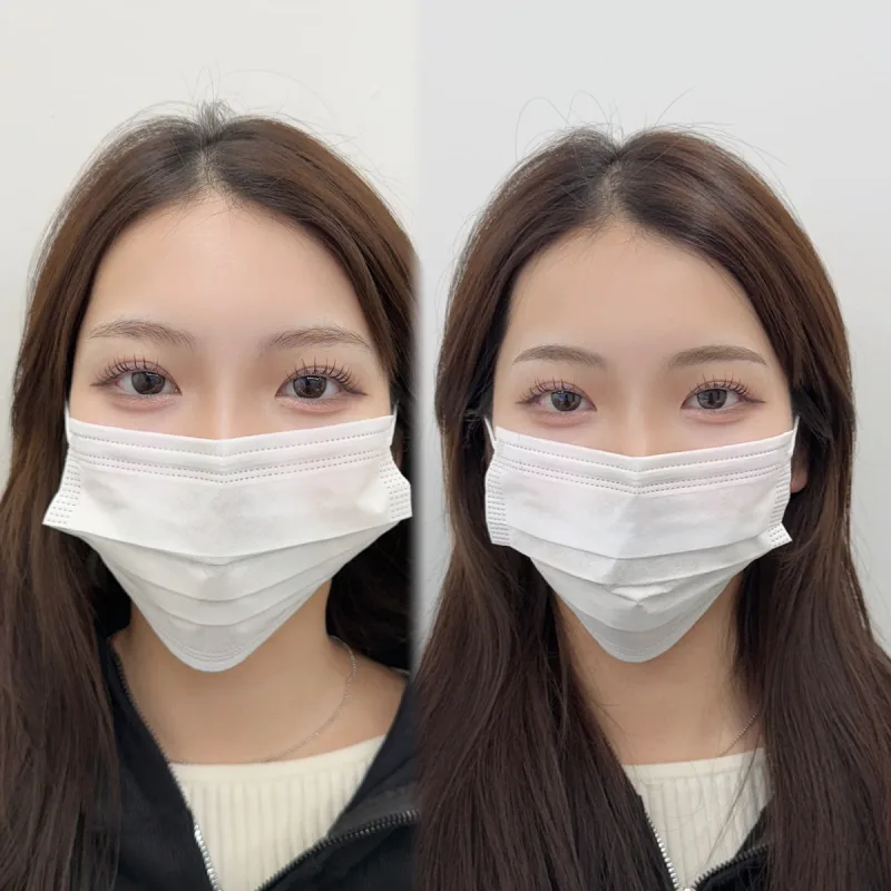 IRO ARTMAKE 眉アートメイクの施術前後の比較