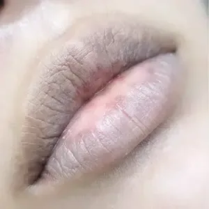 Delumina Beauty 明洞店 リップアートメイクの施術前