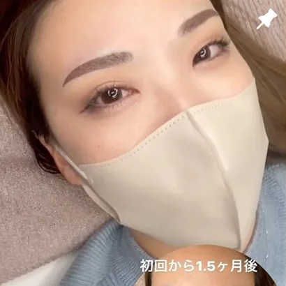 眉アートメイクの施術前後