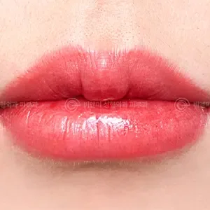 Be&Me Clinic リップアートメイクの施術後