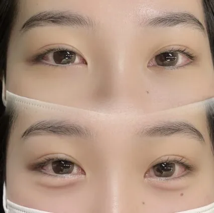 BROWDOLL 眉アートメイクの施術前後の比較
