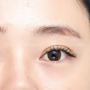 Be&Me Clinic 眉アートメイクの施術前