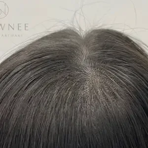 BROWNEE 頭皮アートメイク（SMP）の施術後