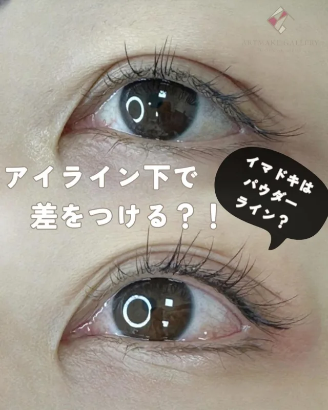 Tina（山田）のアートメイク症例写真（アートメイクギャラリー）