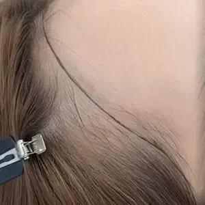 IRO ARTMAKE ヘアラインアートメイクの施術前