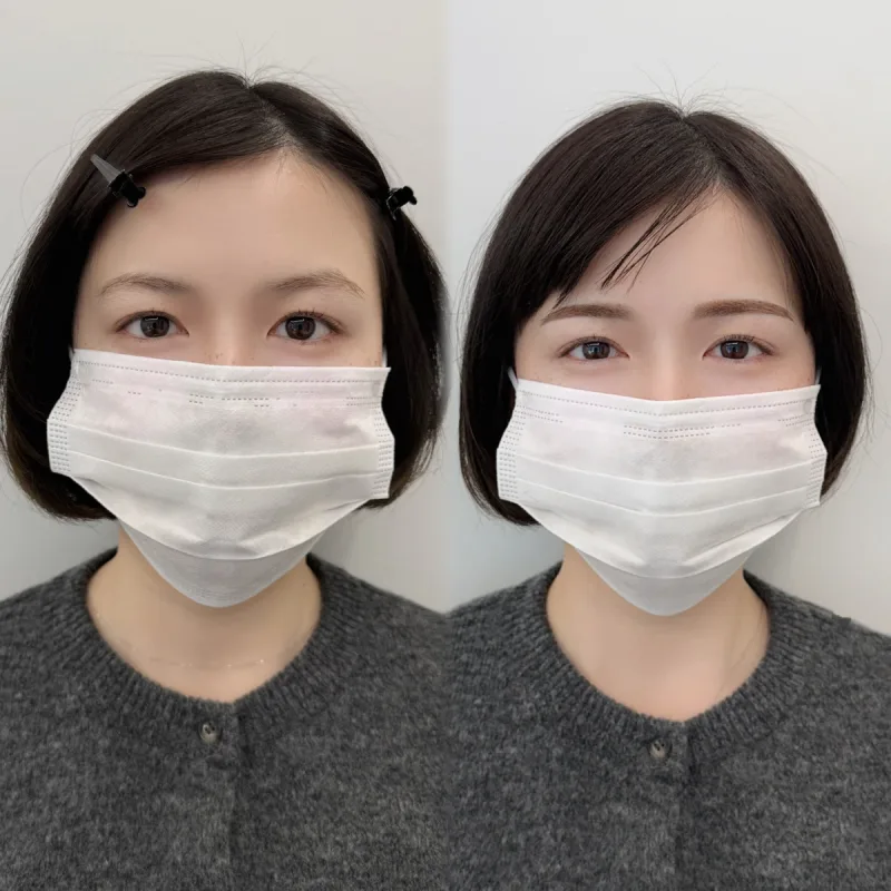 IRO ARTMAKE 眉アートメイクの施術前後の比較