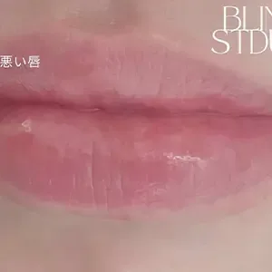 BLINK STUDIO 明洞店 リップアートメイクの施術前
