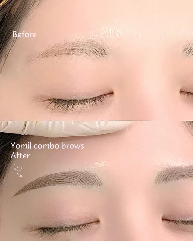 Yomil beauty コンボブロウ（眉アートメイク）の施術前後の比較
