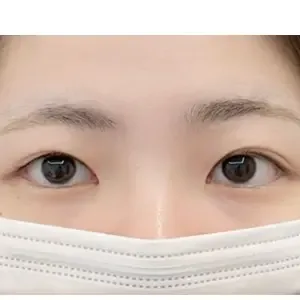 IRO ARTMAKE 眉アートメイクの施術前