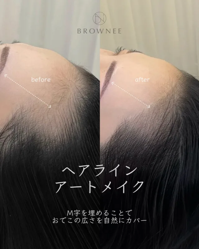 BROWNEE ヘアラインアートメイクの施術前後を並べたバナー
