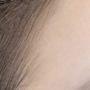BLINK STUDIO 明洞店 ヘアラインアートメイクの施術後