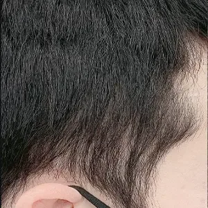 SOPHICATE（ソフィーケイト） ヘアラインアートメイクの施術前