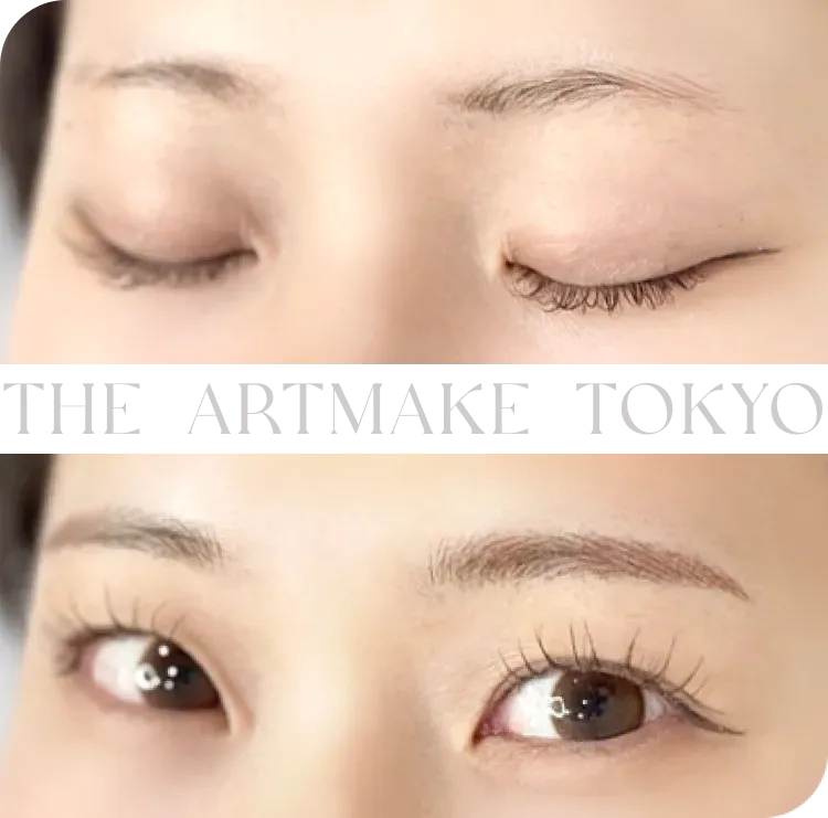 ジ・アートメイク東京 銀座院の眉アートメイク症例写真