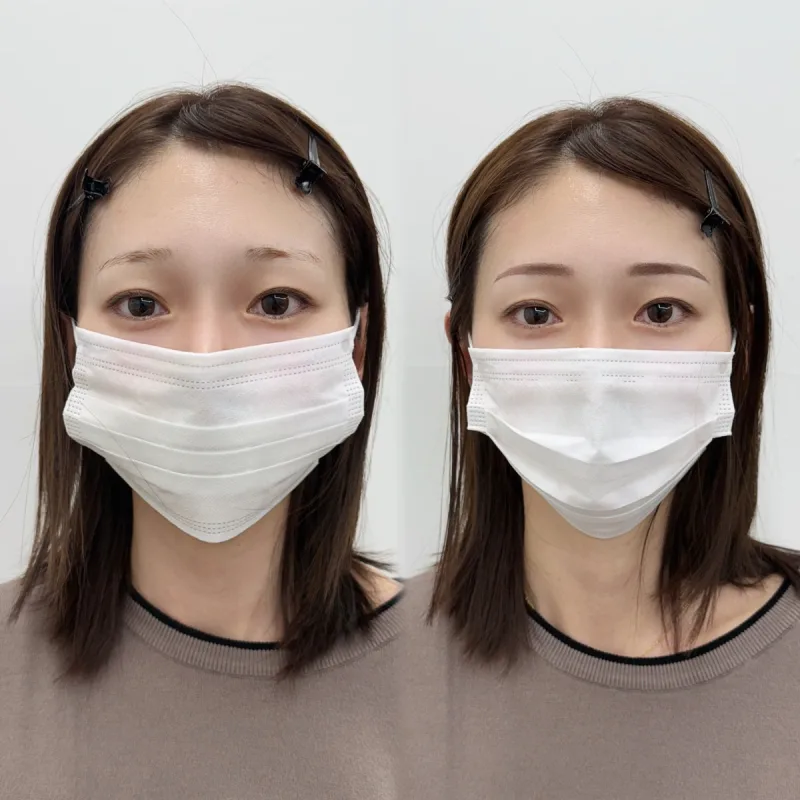IRO ARTMAKE 眉アートメイクの施術前後の比較
