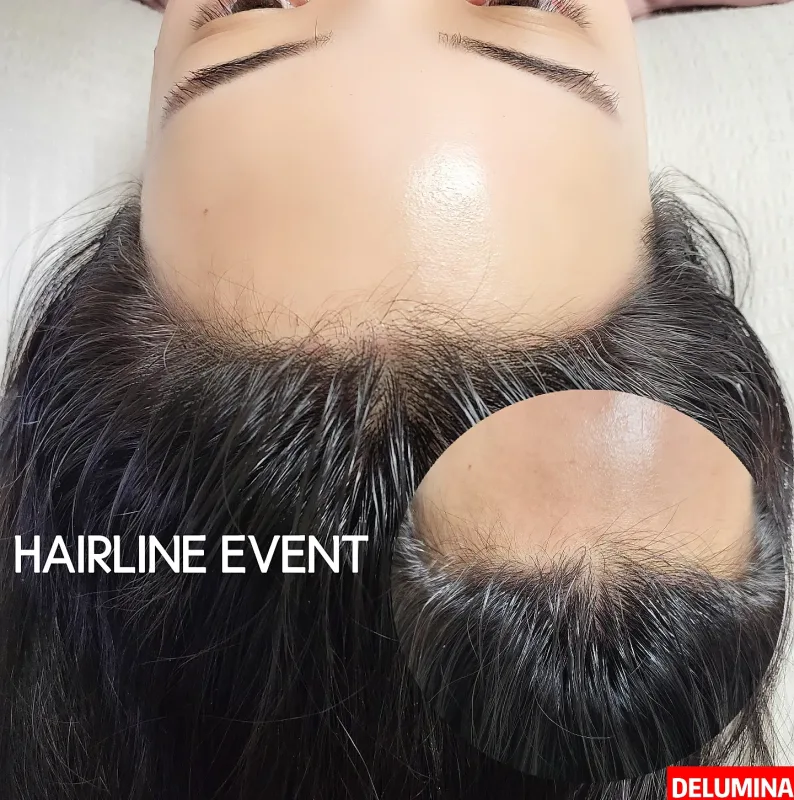 Delumina Beauty 明洞店 ヘアラインアートメイクの施術前後の比較