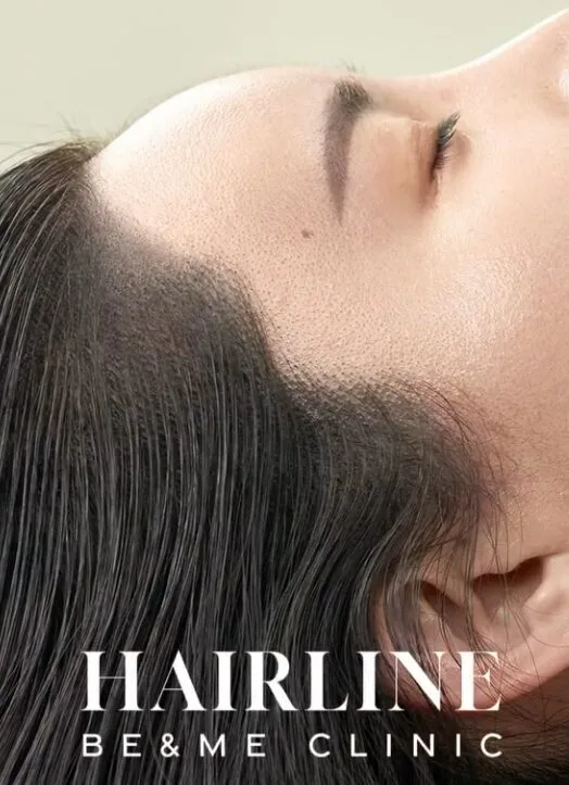 Be&Me Clinic ヘアラインアートメイクの仕上がり