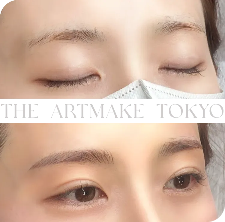 ジ・アートメイク東京 大阪院の眉アートメイク症例写真