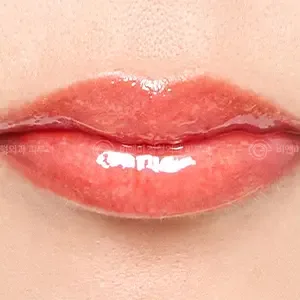 Be&Me Clinic リップアートメイクの施術後
