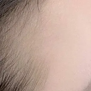 BLINK STUDIO 明洞店 ヘアラインアートメイクの施術前