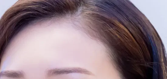 ヘアラインアートメイク