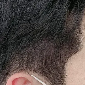 SOPHICATE（ソフィーケイト） ヘアラインアートメイクの施術後