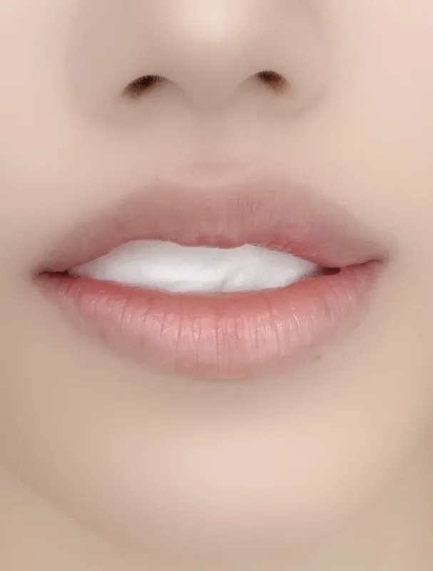 LIP BEFORE