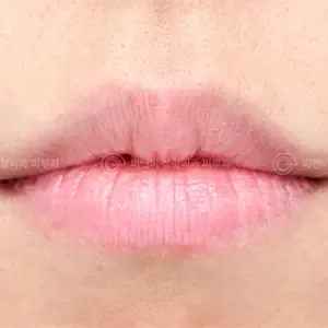 Be&Me Clinic リップアートメイクの施術前
