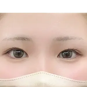 IRO ARTMAKE 眉アートメイクの施術前